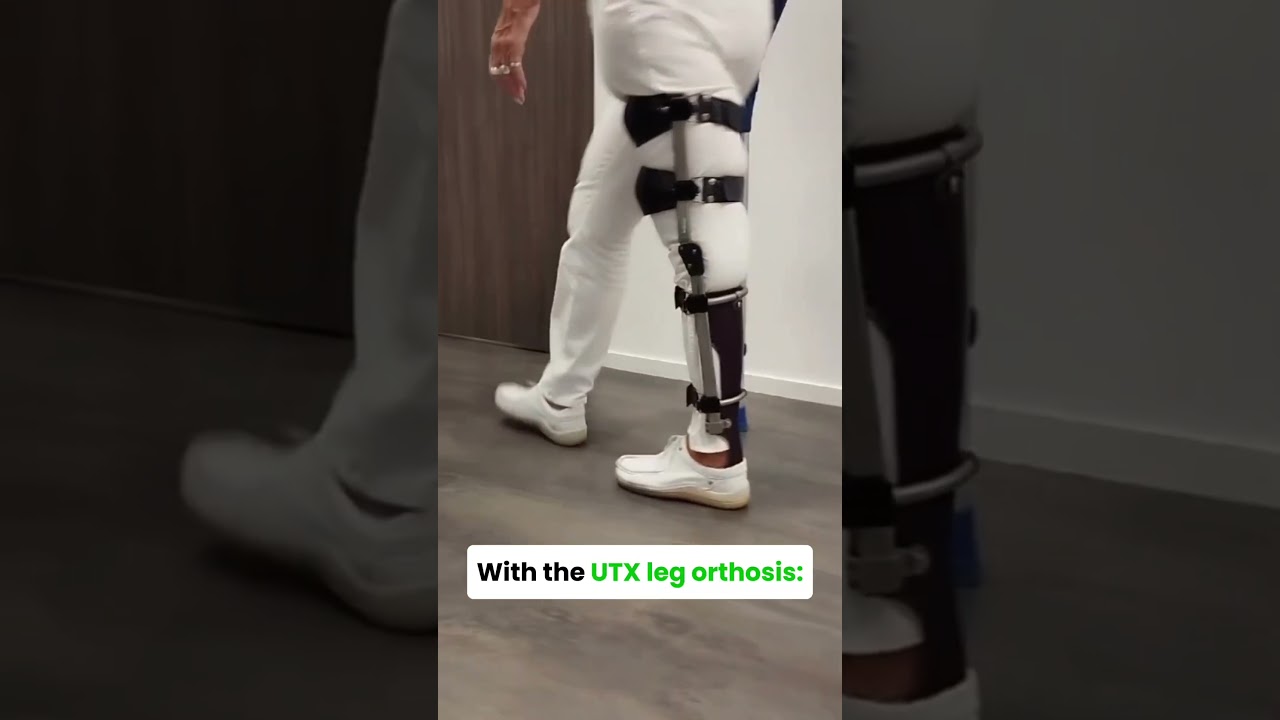 Hyperextension of the knee, before and after the UTX leg brace