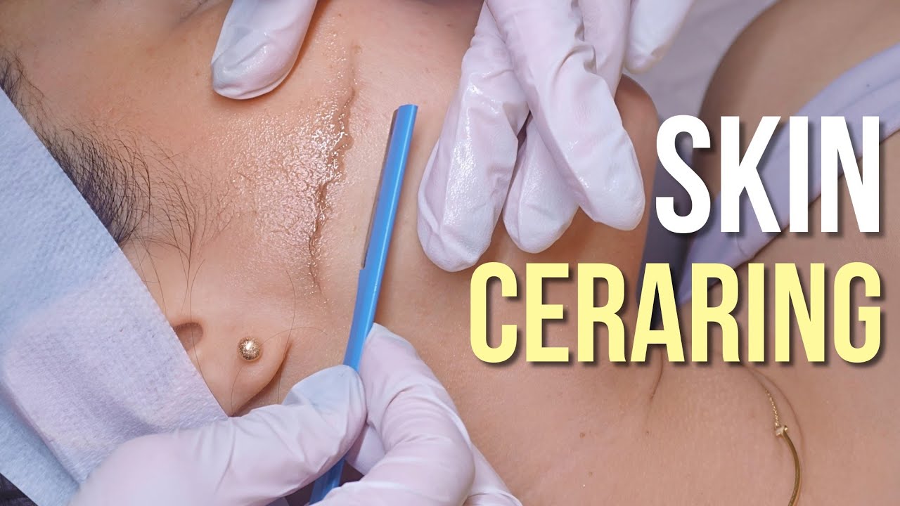 ASMR 😪 Tingle Revolution: Flawless Skin with 3rd Gen Dermaplaning 'Ceraring'