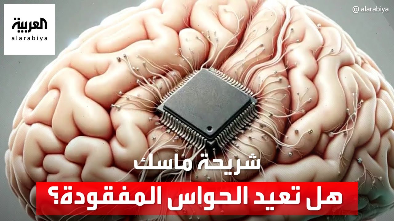شريحة ماسك الدماغية.. هل تعيد الحواس المفقودة؟
