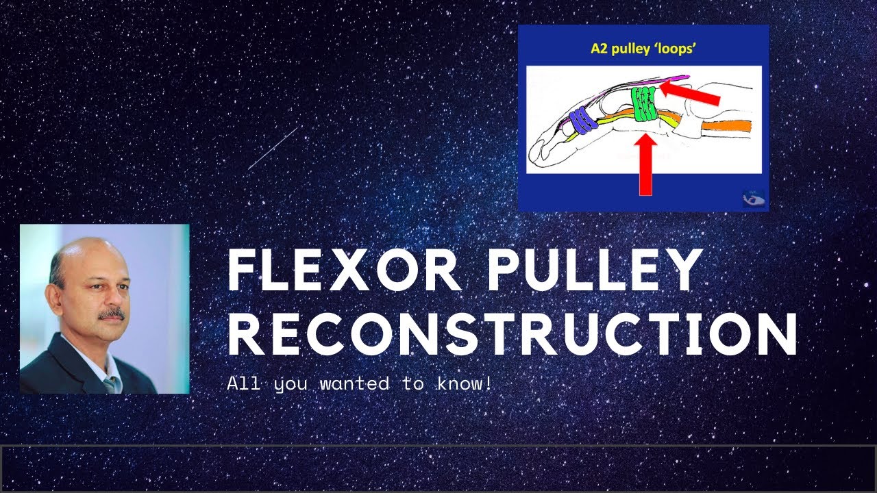 Реконструкция сухожилий сгибателей — всё, что вы хотели знать! #flexortendon