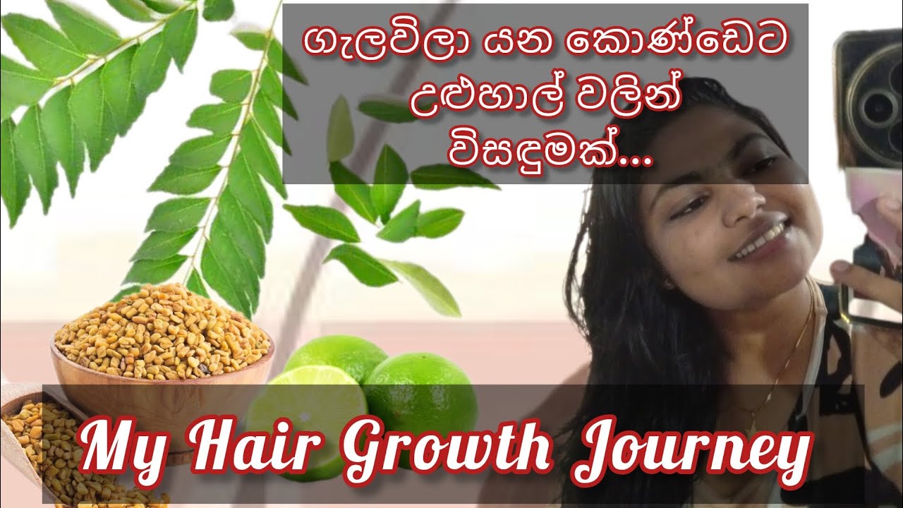 ✨ My Hair Growth Journey | ගැලවීලා යන කොණ්ඩෙට උත්තරයක් ✨ #hairgrowth #natural #day #shashiniimasha 