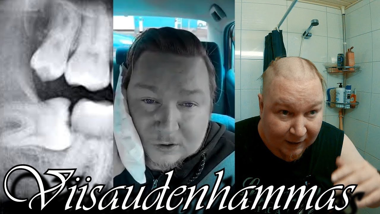 Viisaudenhammas || VLOGI