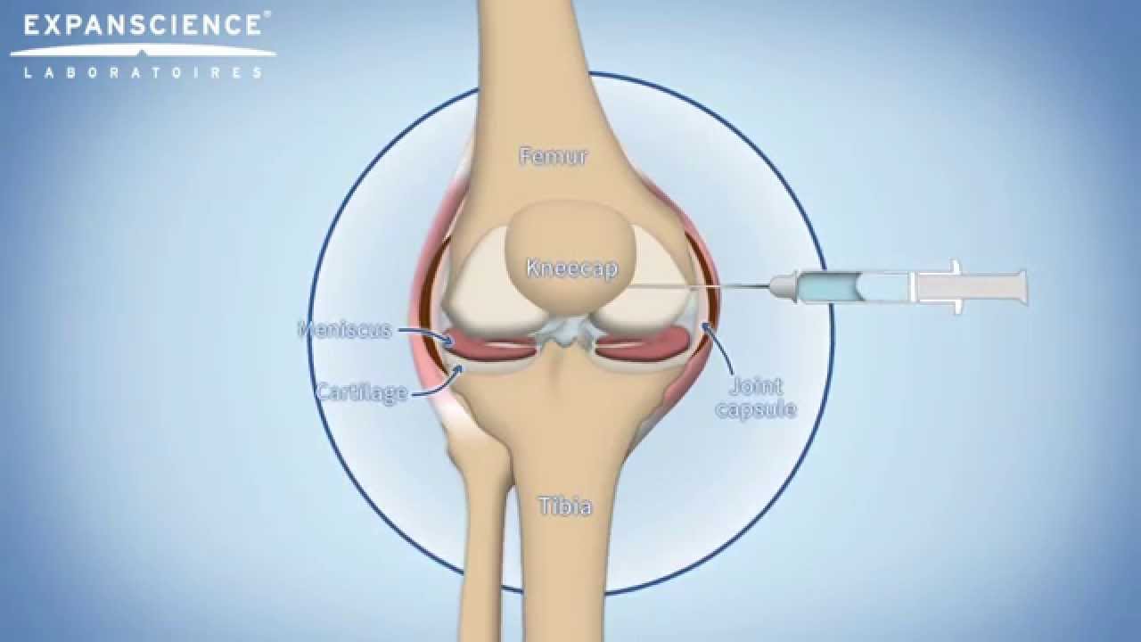 Вискодобавки