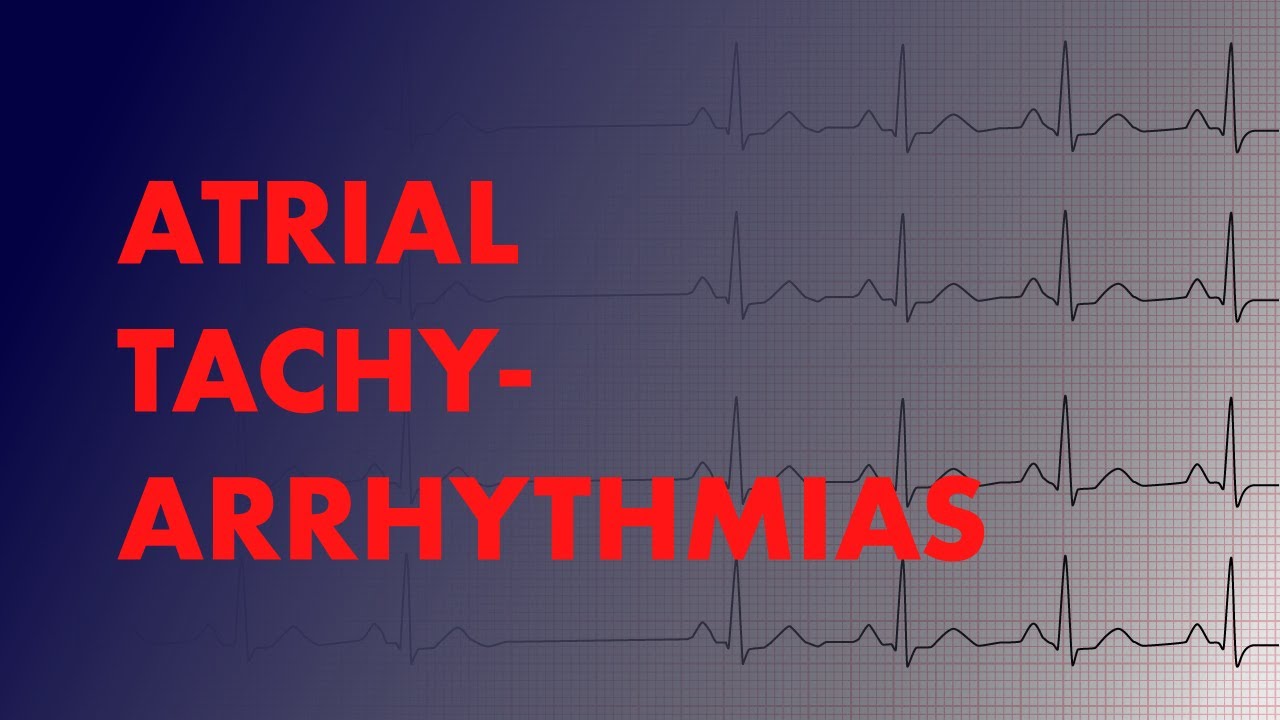 Atrial Arrhythmias (A-fib vs A-Flutter vs Focal vs Multifocal Atrial Tachycardia) - MEDZCOOL