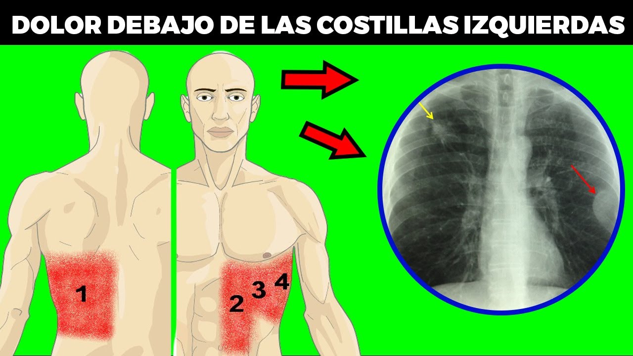 DOLOR DEBAJO de las COSTILLAS del LADO IZQUIERDO: causas, tratamiento y cuando acudir al m&eacute;dico