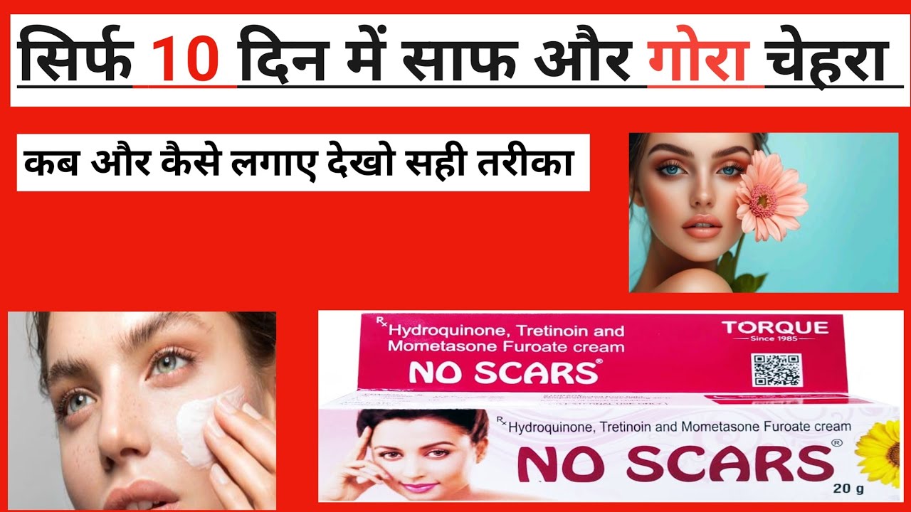 No Scars Cream | No Scars Cream Review | 2025 | how to use no scars cream फायदे और नुकसान