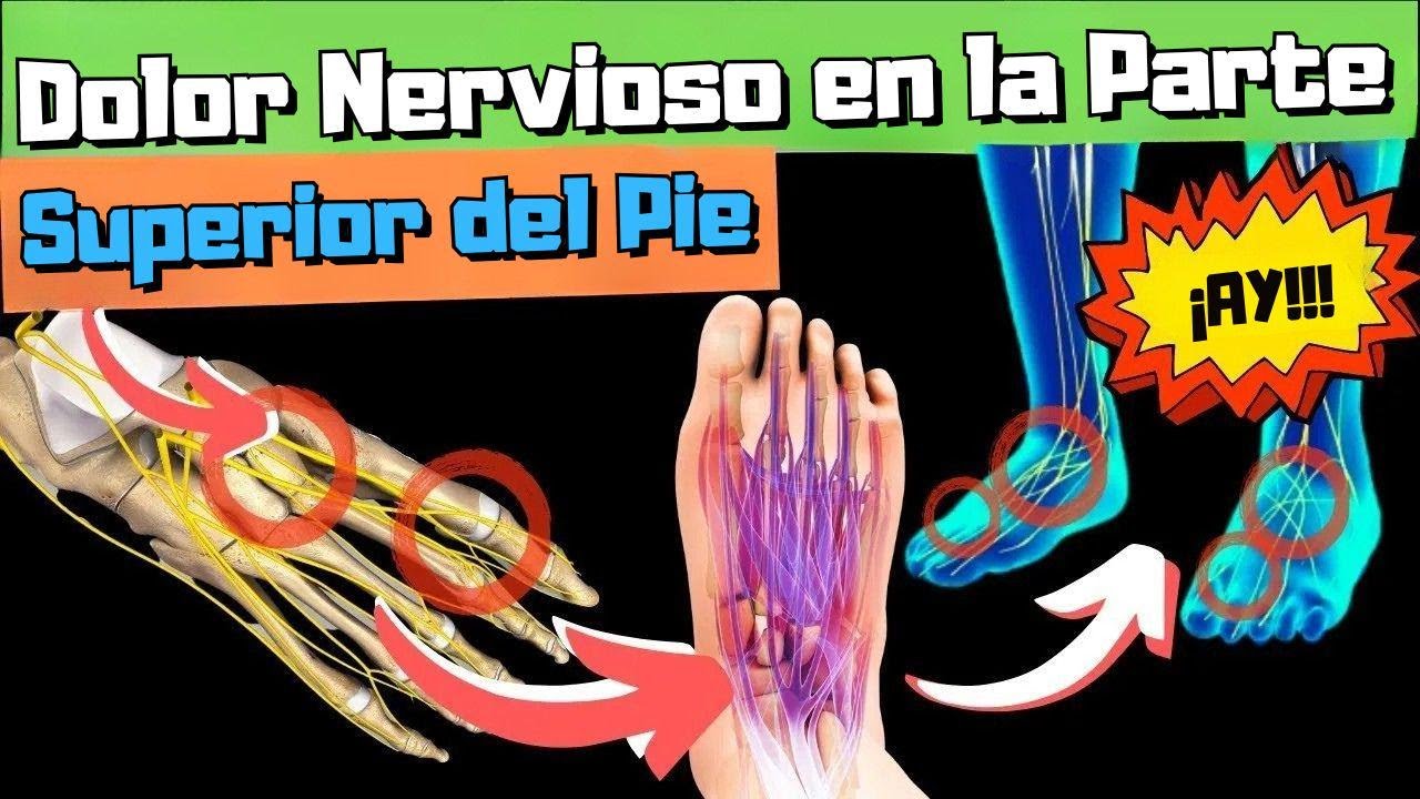 ¿Dolor intenso, ardor o cosquilleo en el empeine? ¡Soluciona ese dolor de nervio!