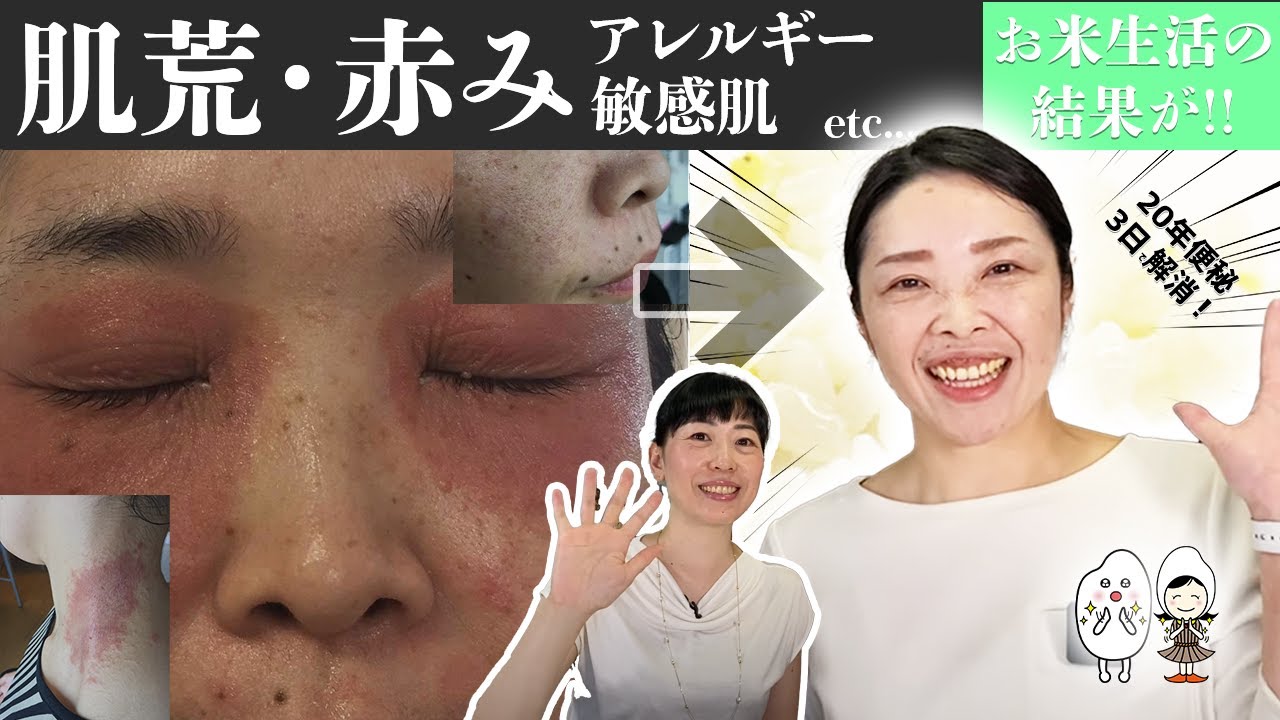 【※衝撃写真 有】圧倒的に腸が整う。美肌と健康は体内から👩【お米生活】【即効・便秘解消食材】【肌荒れ改善食材】【スキンセラピスト 石田陽子さん】