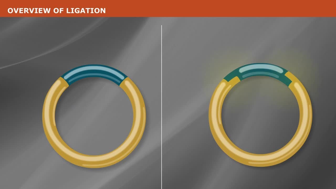 DNA Ligation
