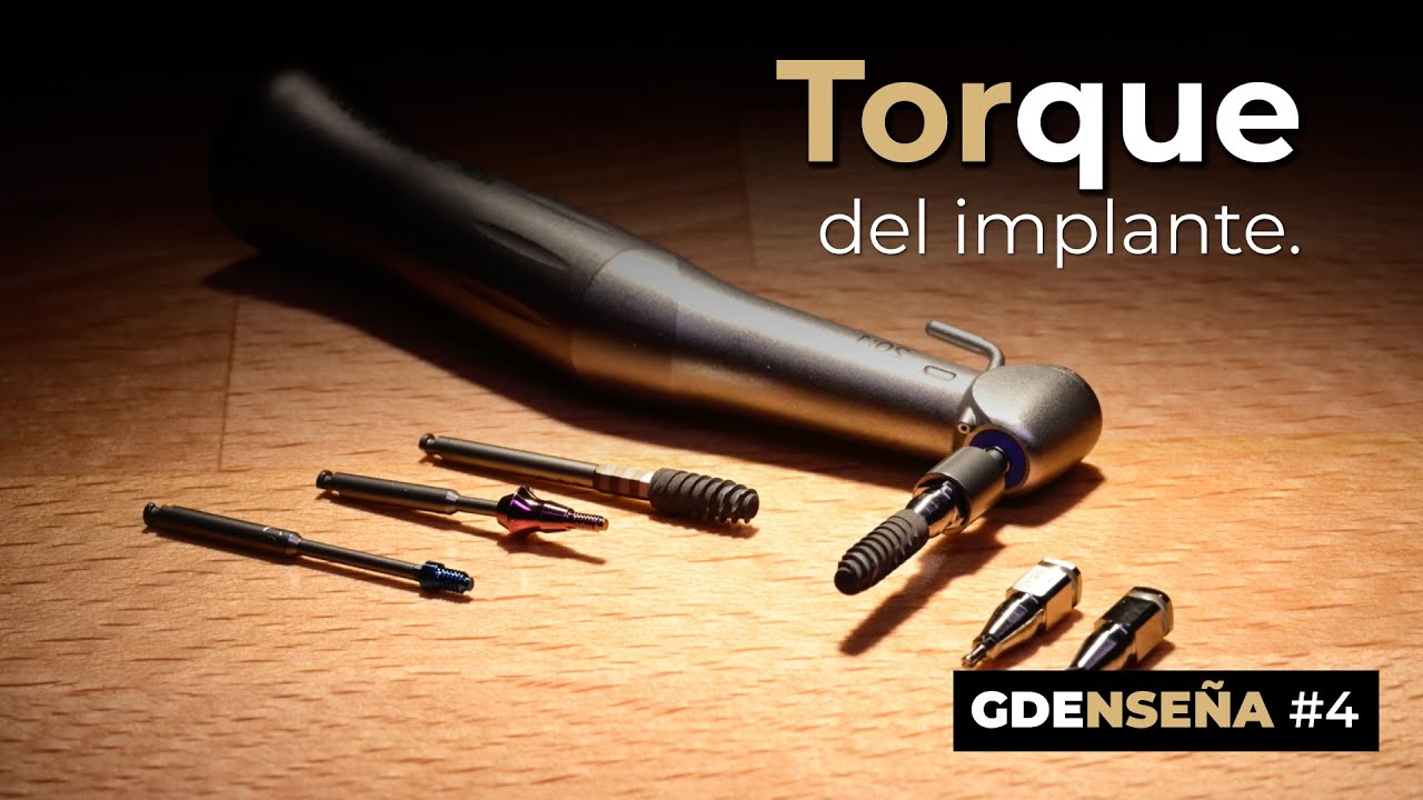 🔎 Torque de inserción, de ajuste de pilares y tornillos protésicos. GDENSEÑA #4