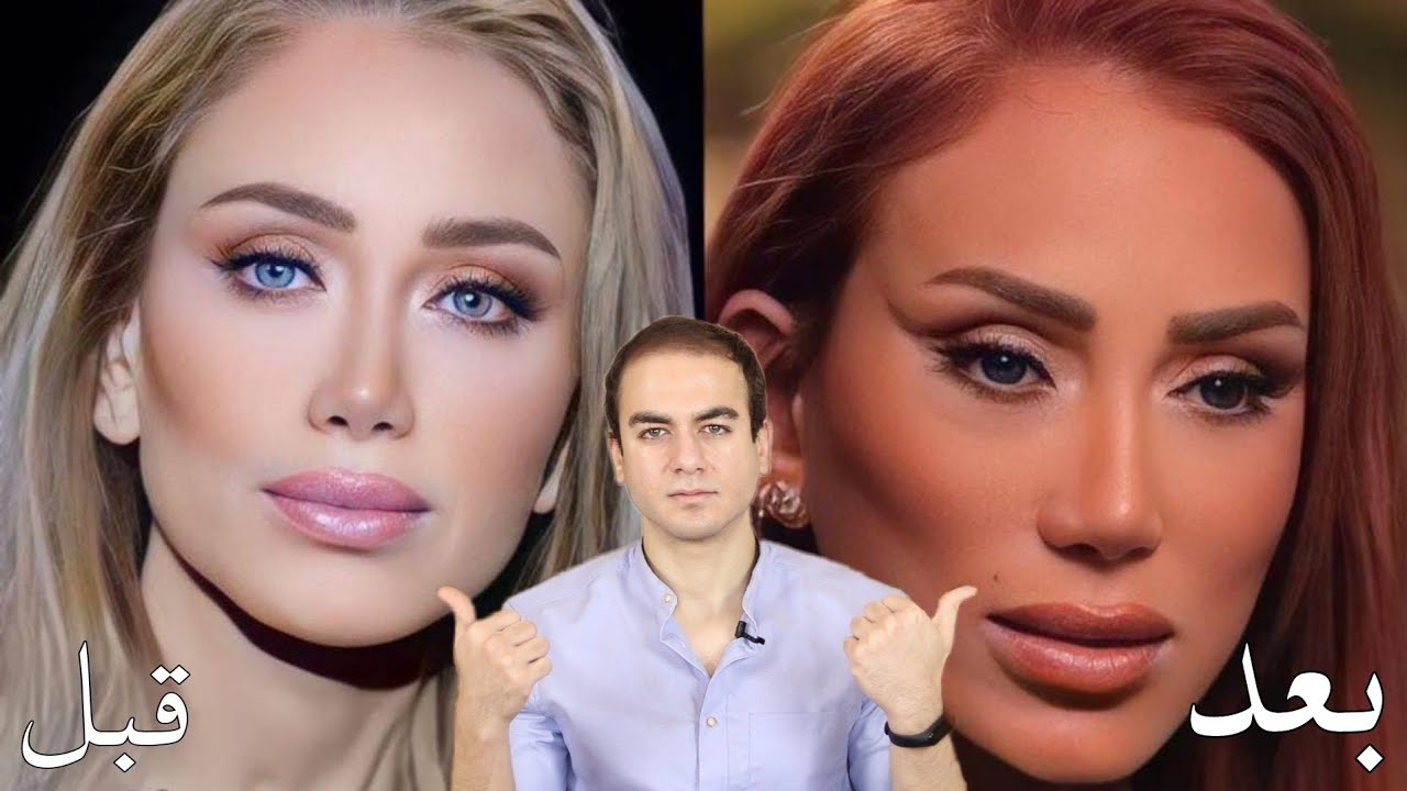 Пластический хирург объясняет, что на самом деле произошло с лицом Рехама Саида.