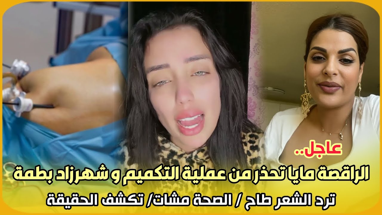 عاجل..الراقصة مايا تحذر من عملية التكميم و شهرزاد بطمة ترد الشعر طاح / الصحة مشات/ تكشف الحقيقة