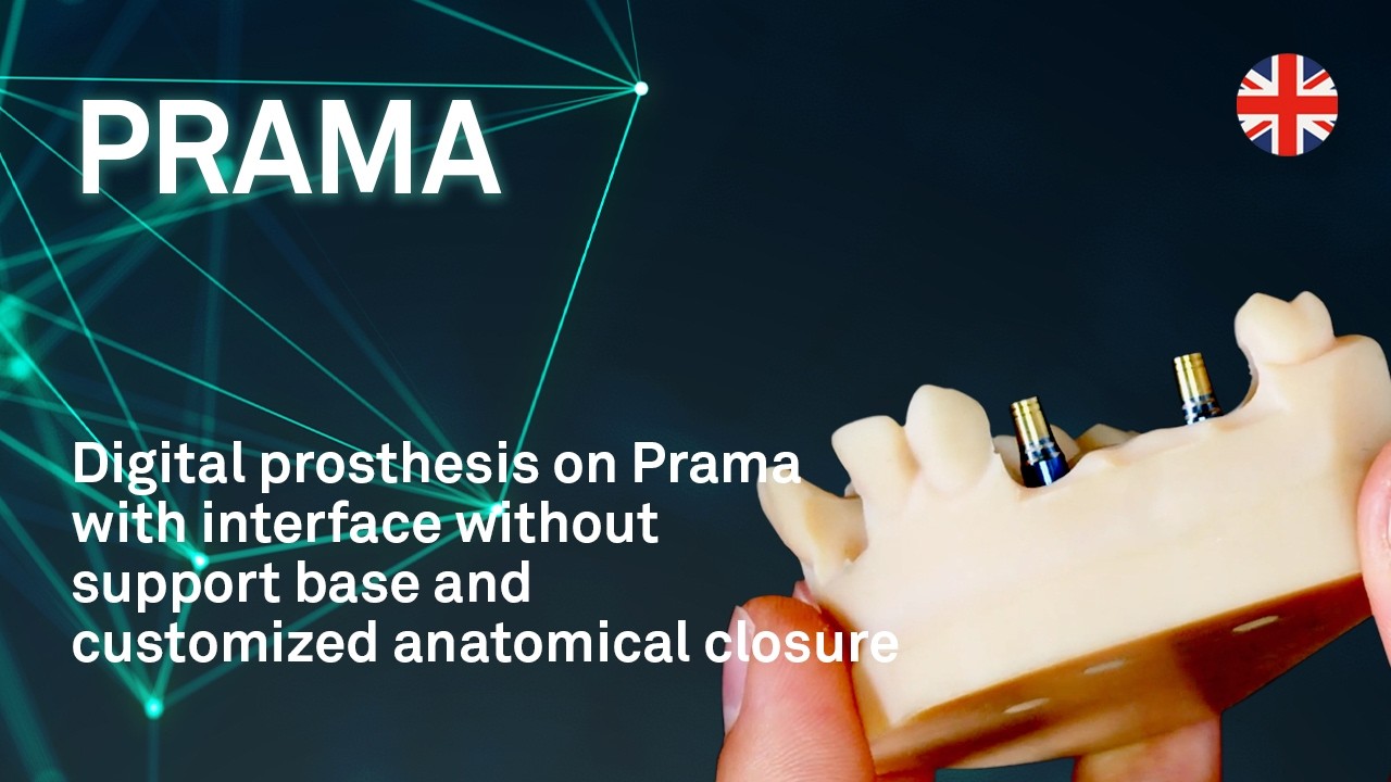 Digital prosthesis on Prama with interface without support base and customized anatomical closure