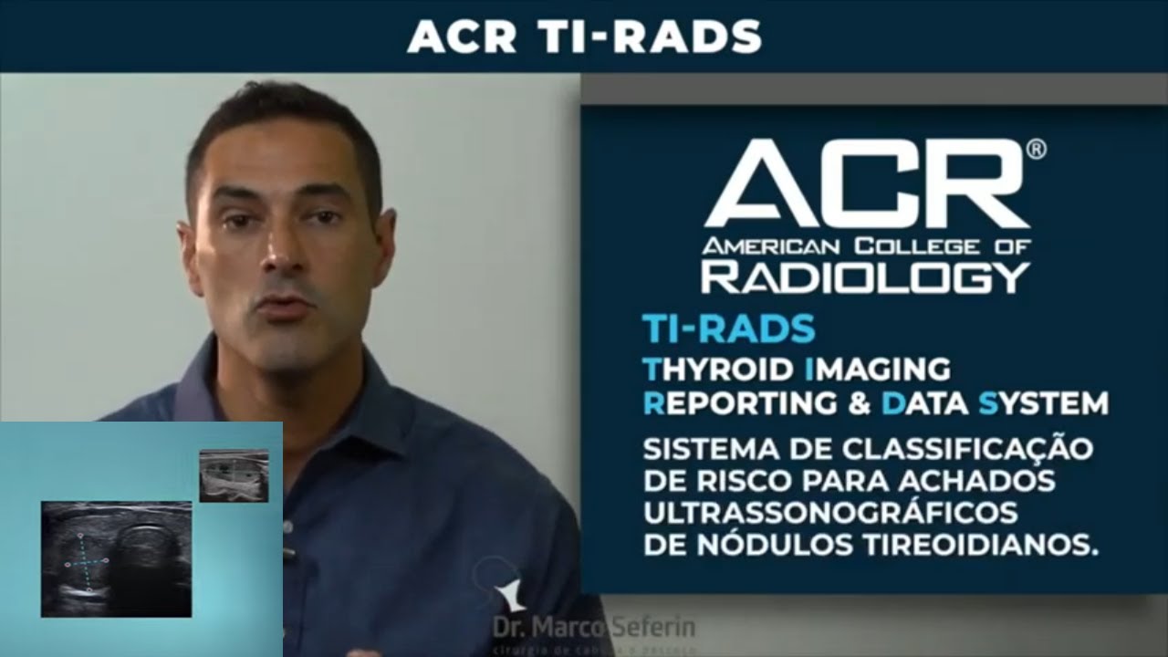 TI-RADS: o que é e como calcular o ACR TI-RADS no exame de ultrassom da tireoide.