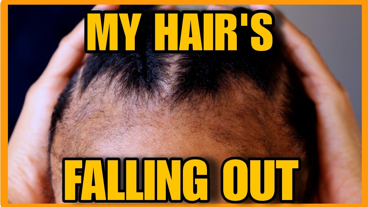 Losing My Hair After Giving Birth | My Raw Postpartum Hair Journey