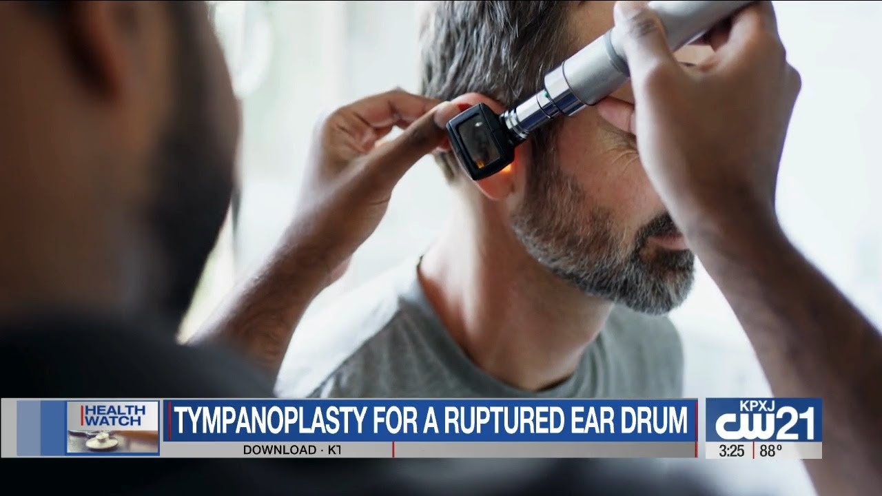 Modern advances in tympanoplasty: How surgeons repair a perforated eardrum