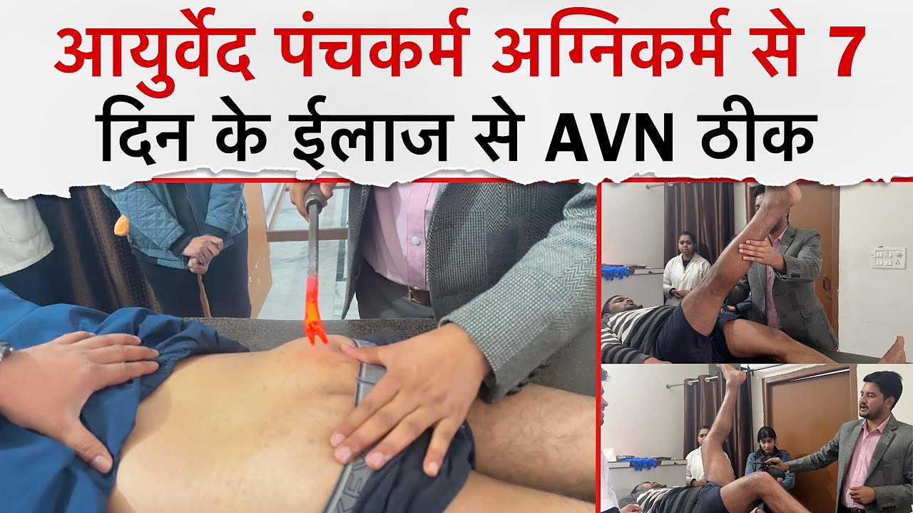 आयुर्वेद पंचकर्म अग्निकर्म से AVN होता है , बस 7 दिन के ईलाज से ठीक,Sushrut Ayurved Darshan Hospital