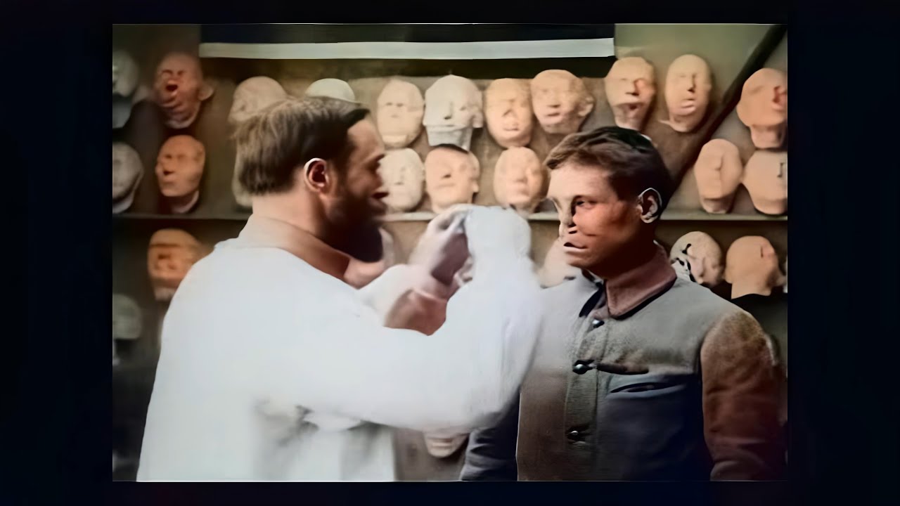 [4k, 50fps, colorized] (1918). The birth of plastic surgery.