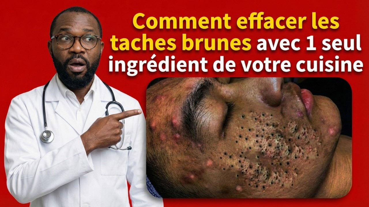 Comment effacer les taches brunes avec 1 seul ingrédient de votre cuisine