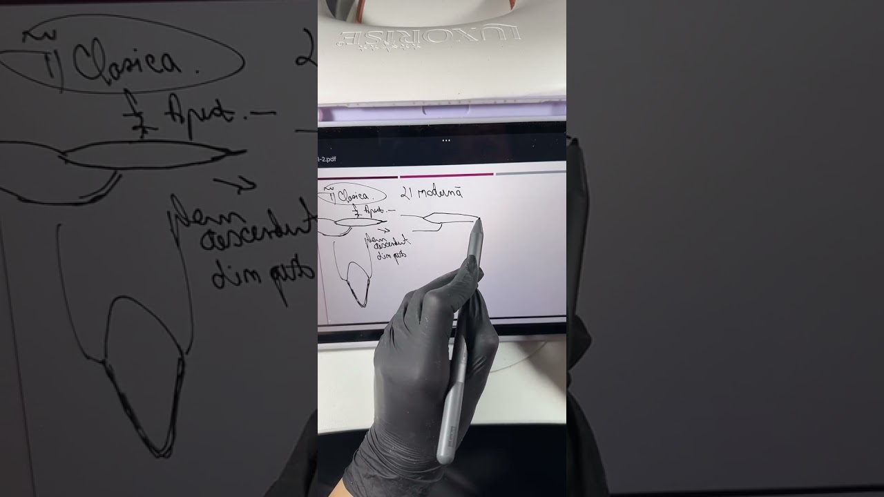 Inregistrarea Live-ului Tipuri de Migdale - Trainer Rodica Musala