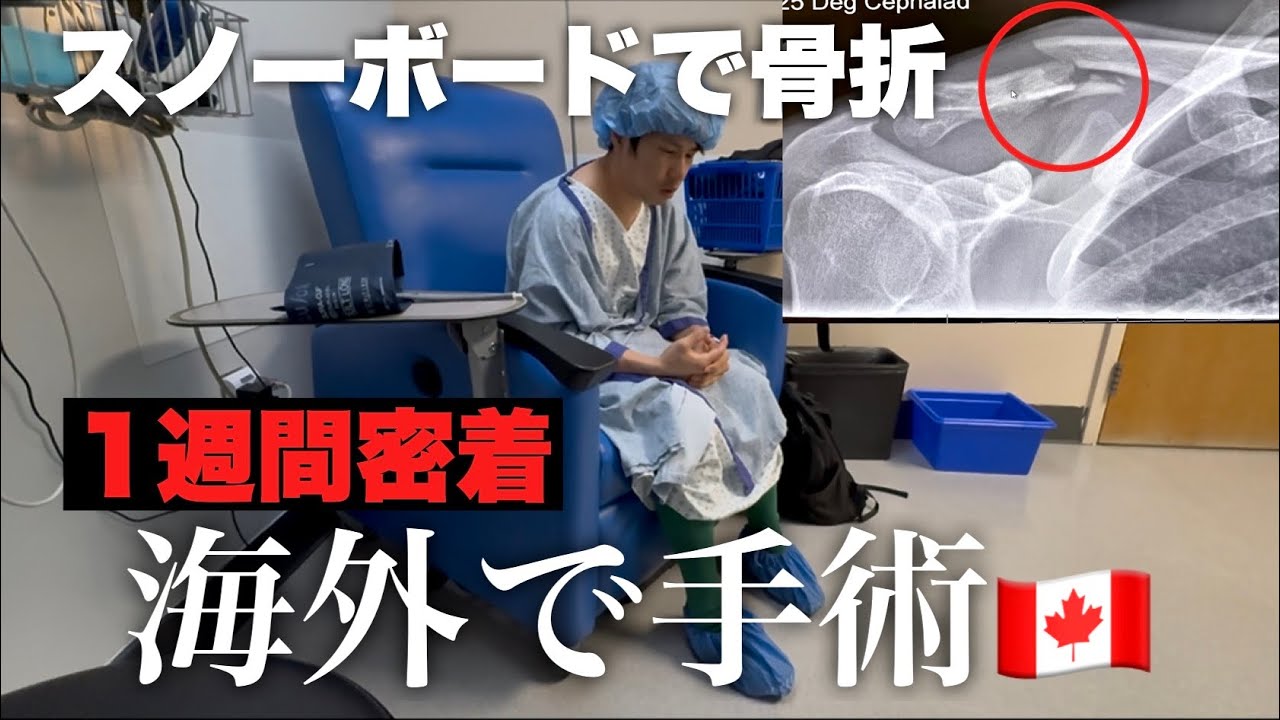 【カナダ在住夫婦】夫がスノーボードで骨折し手術になりました。