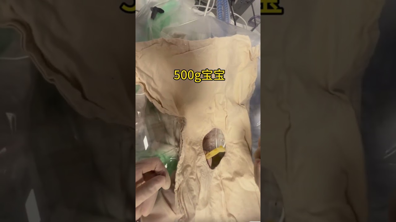 How Big is a 1-Cattie Premature Baby? Growth Milestones  #prematurebaby  #babycare #treatment  #baby
