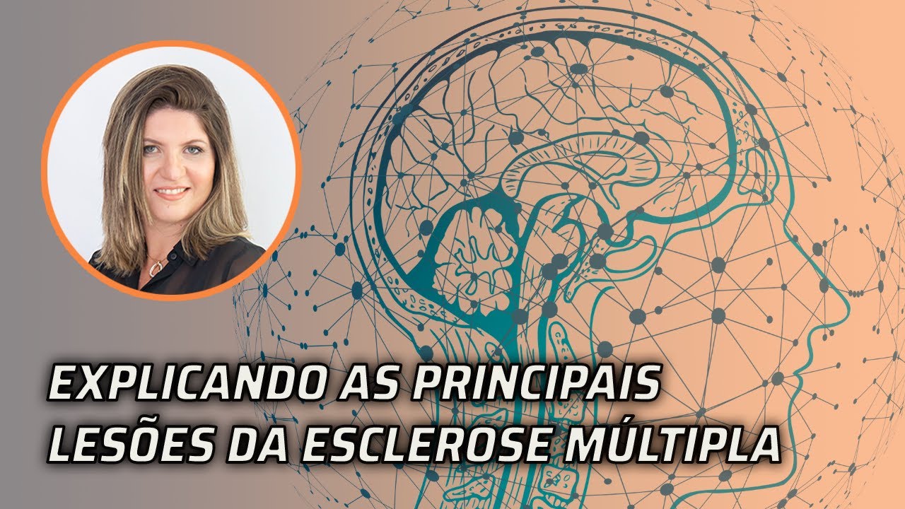 QUAIS SÃO OS PRINCIPAIS TIPOS DE LESÃO NA ESCLEROSE MÚLTIPLA?