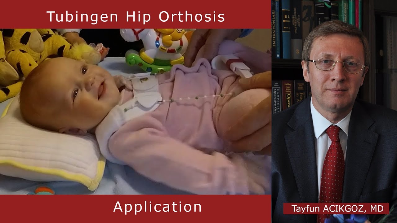 Tubingen Hip Flexion and Abduction Orthosis Application - Tayfun ACIKGOZ, MD
