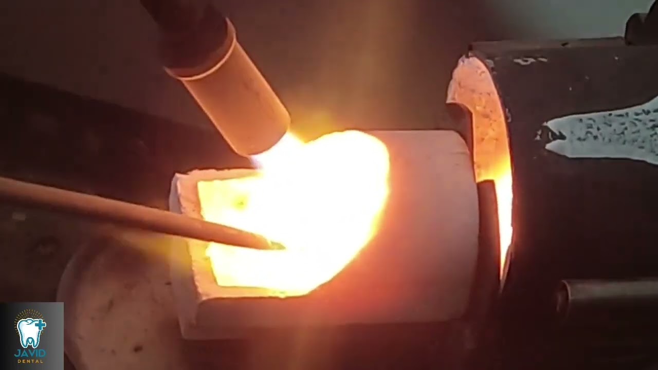 Dental casting / Lost wax casting /   تزریق آلیاژ همراه با توضیحات/ دمکست / سانتریفیوژ / کوره حذف