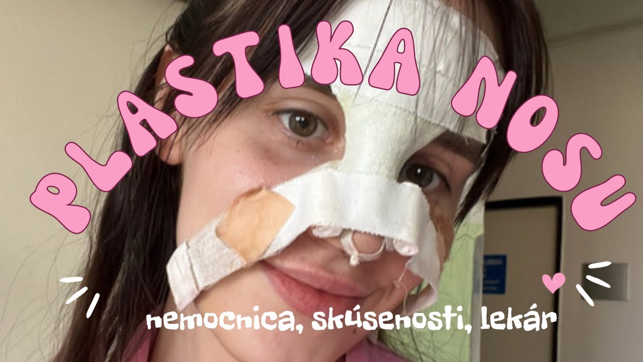 Rhinoplastika operácia nosu: skúsenosti, nemocnica, lekár.