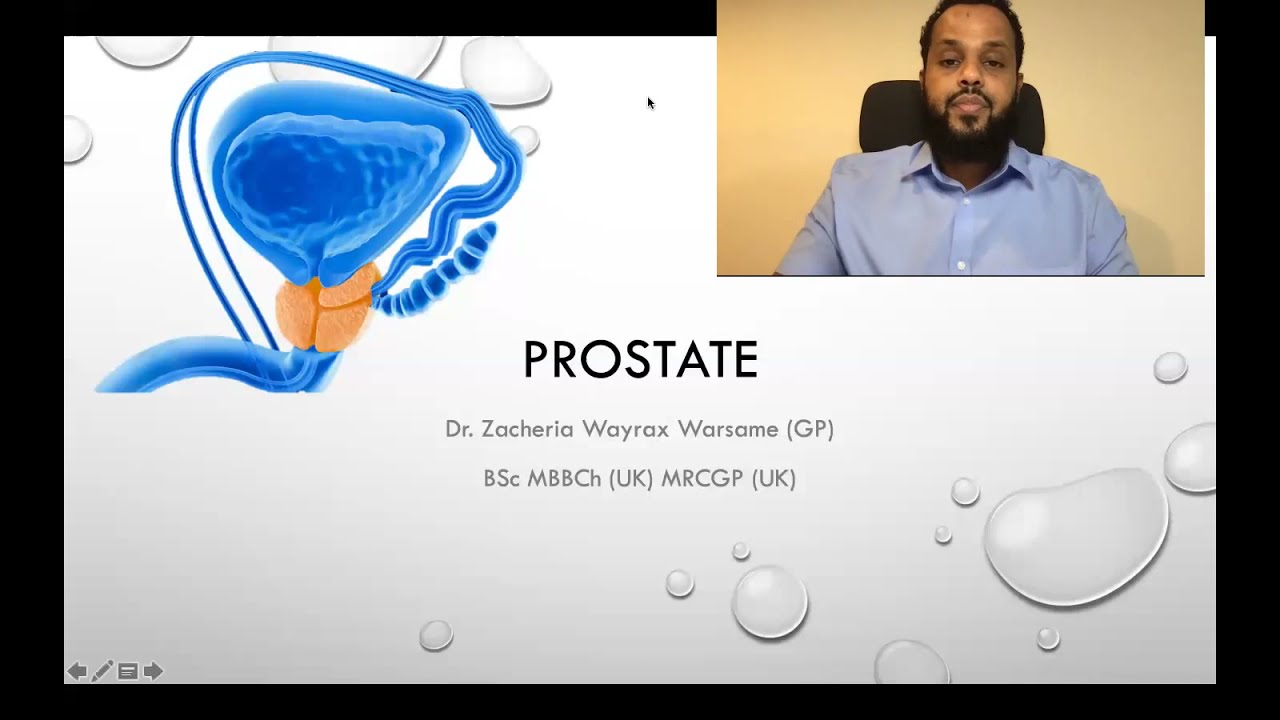 Kansarka iyo Xanuunada ku Dhaca Qanjirka Prostate – DR. WAYRAX (⬇⬇⬇ isticmaal liiska tusmada ⬇⬇⬇)