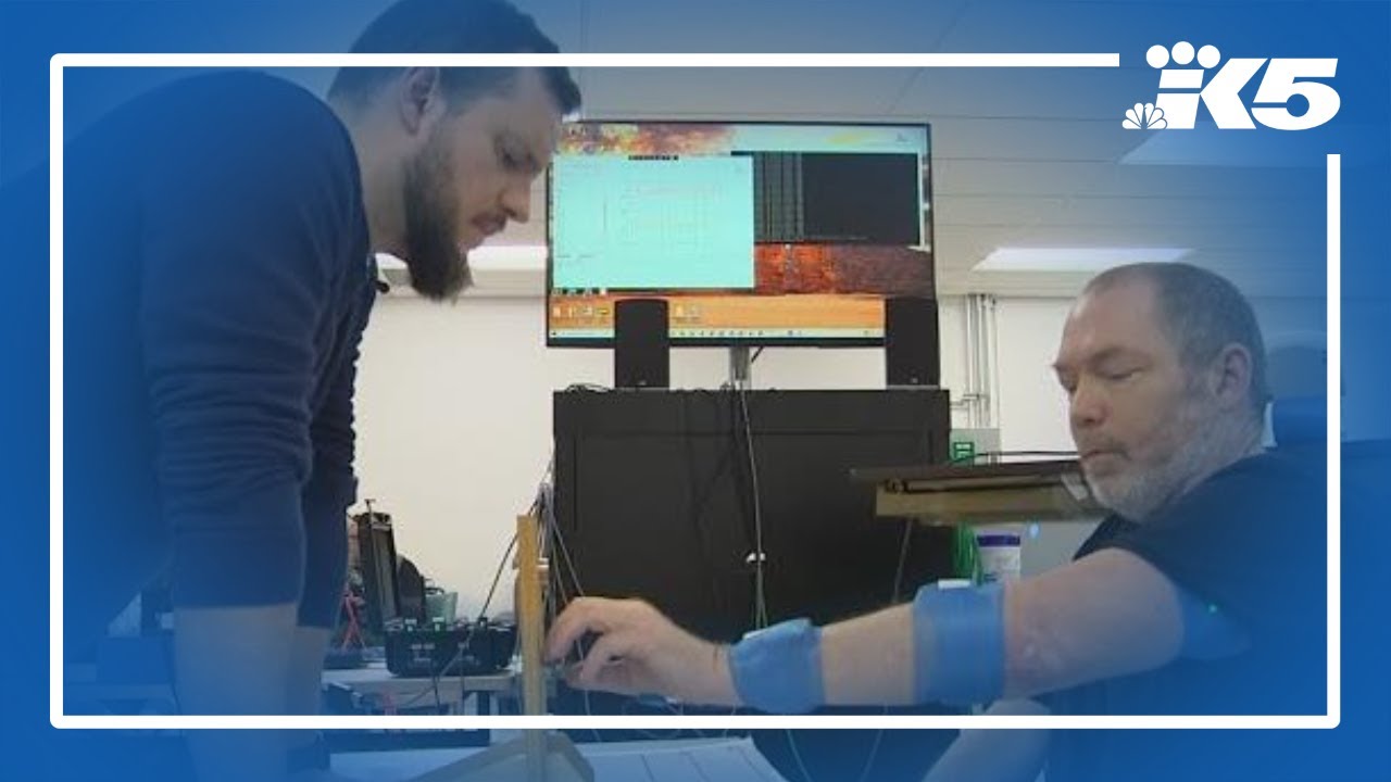 Auburn man regains arm function with brain implant
