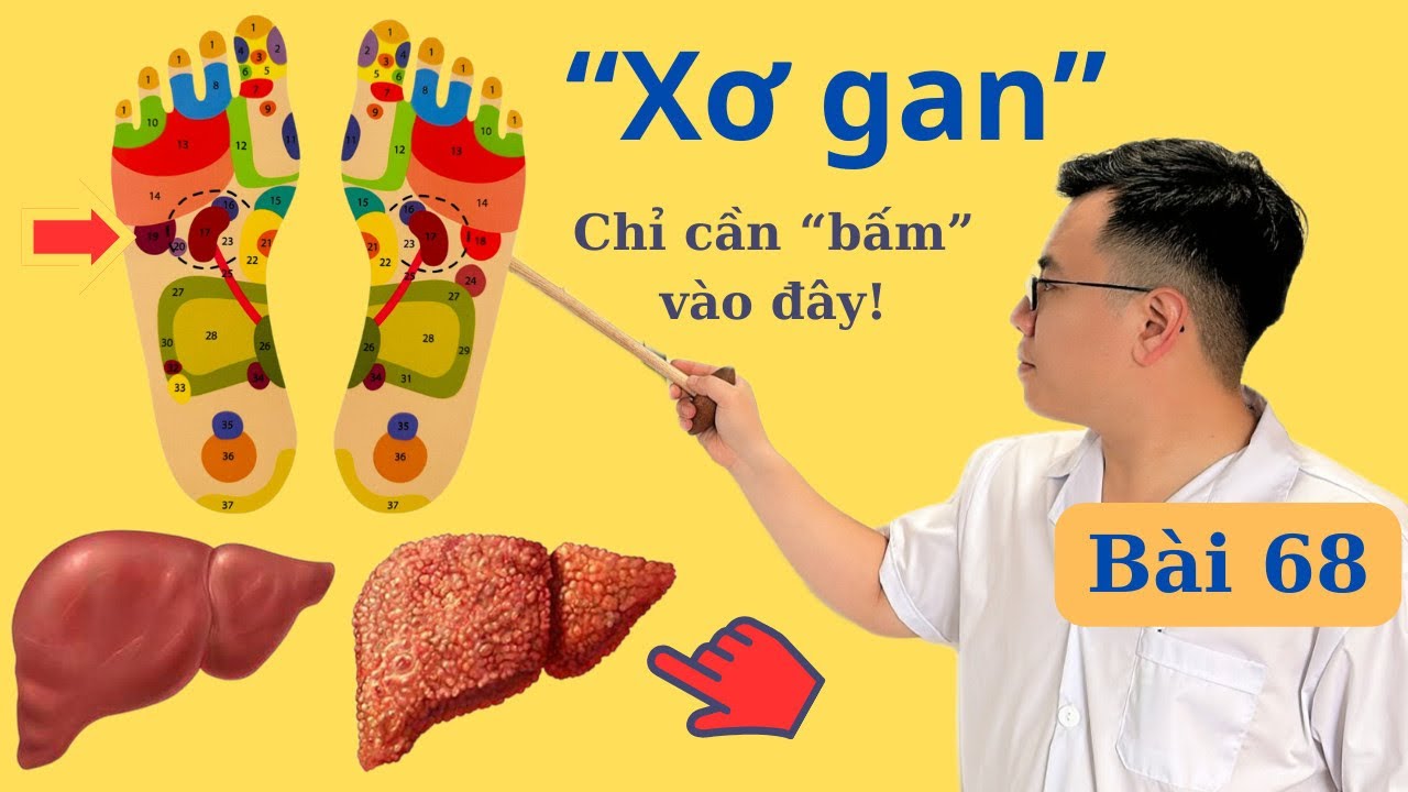 XƠ GAN, nguyên nhân, triệu chứng và cách điều chỉnh | Ds Nguyễn Quốc Tuấn