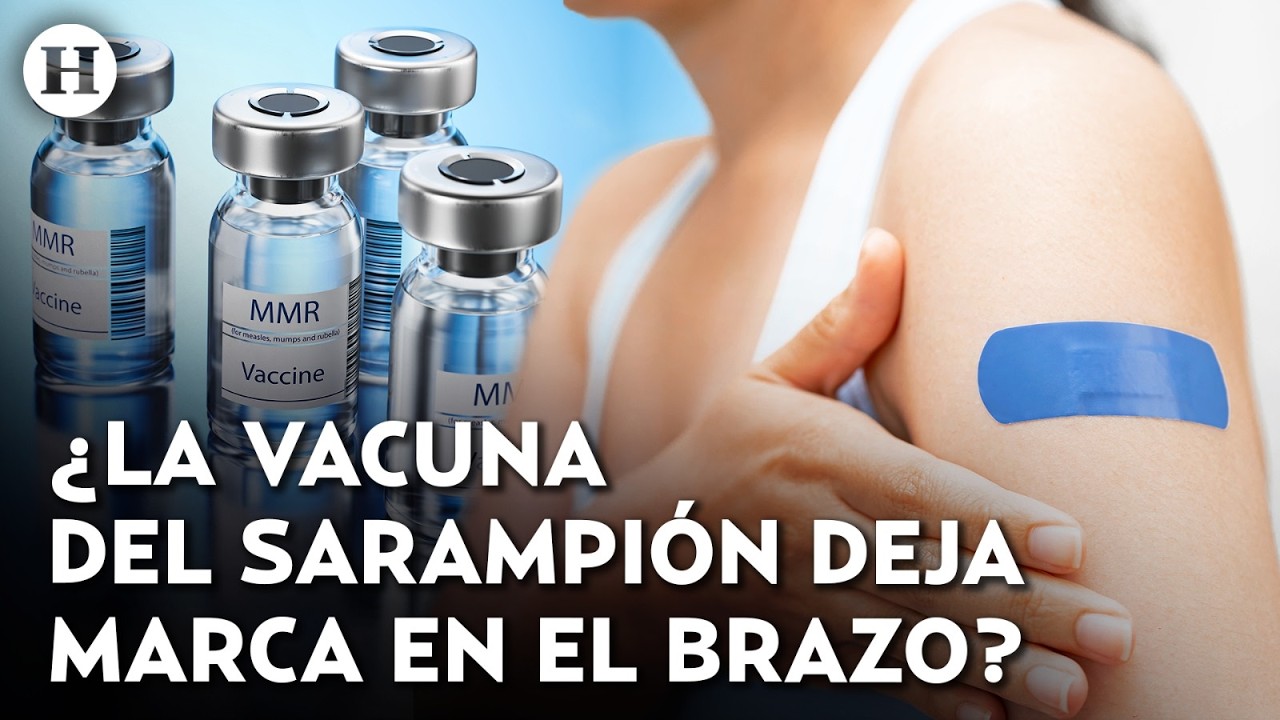 &iquest;Por qu&eacute; en M&eacute;xico se tiene una marca de vacuna en el brazo? Esta es la verdad de la famosa cicatriz