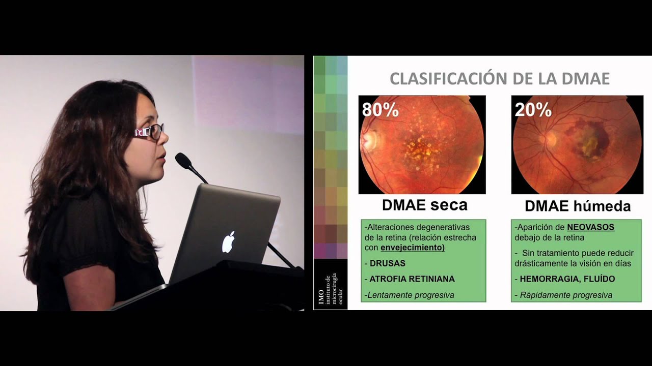 Degeneración Macular (DMAE). Dra. Burés de IMO Barcelona (conferencia completa)