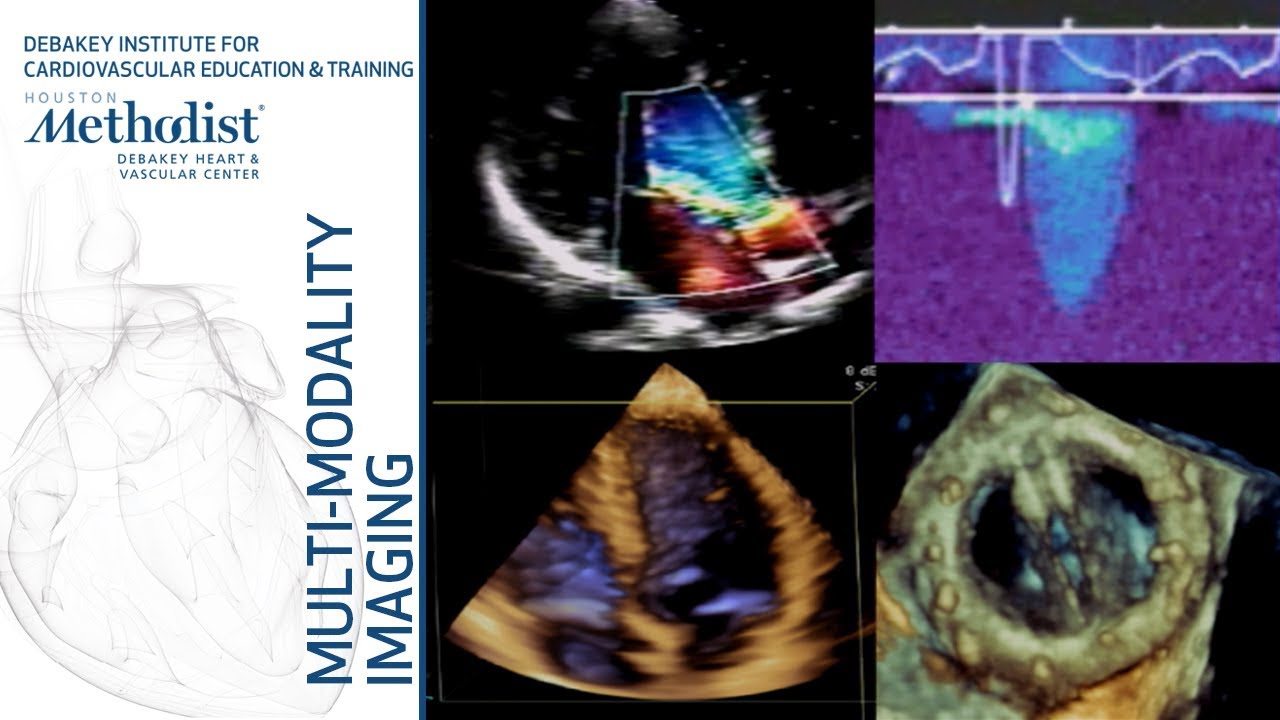 Basic Principles of Echocardiography and Doppler (William A. Zoghbi, MD) September 10, 2019