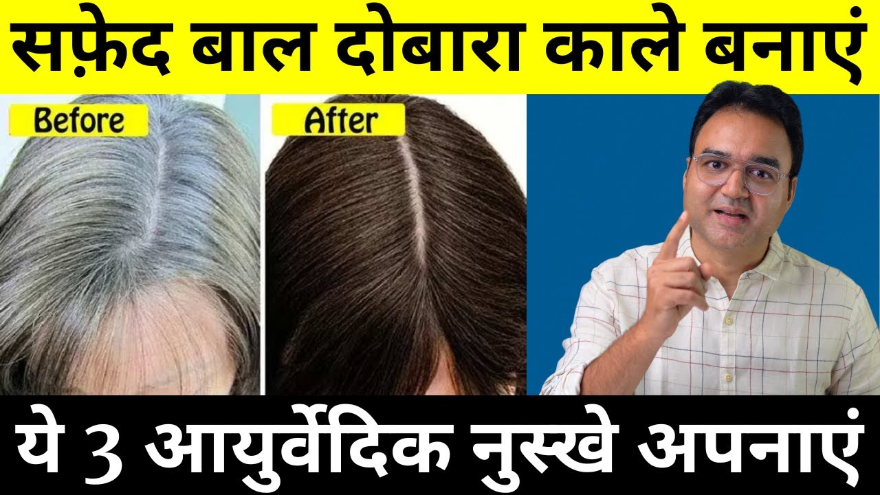 यह तीन चीज़ें 30 दिन लगाओ सारे सफेद बाल काले हो जाएंगे | White Hair To Black Hair Naturally