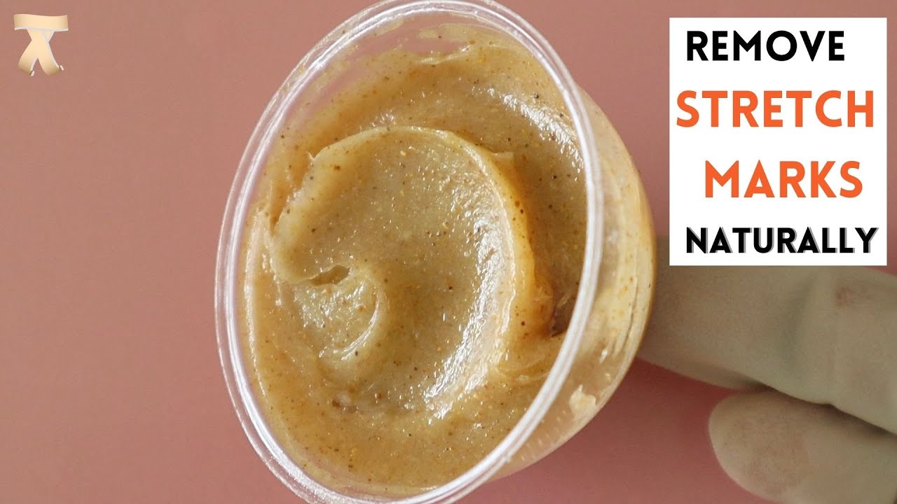 How to make a stretch marks removal cream at home