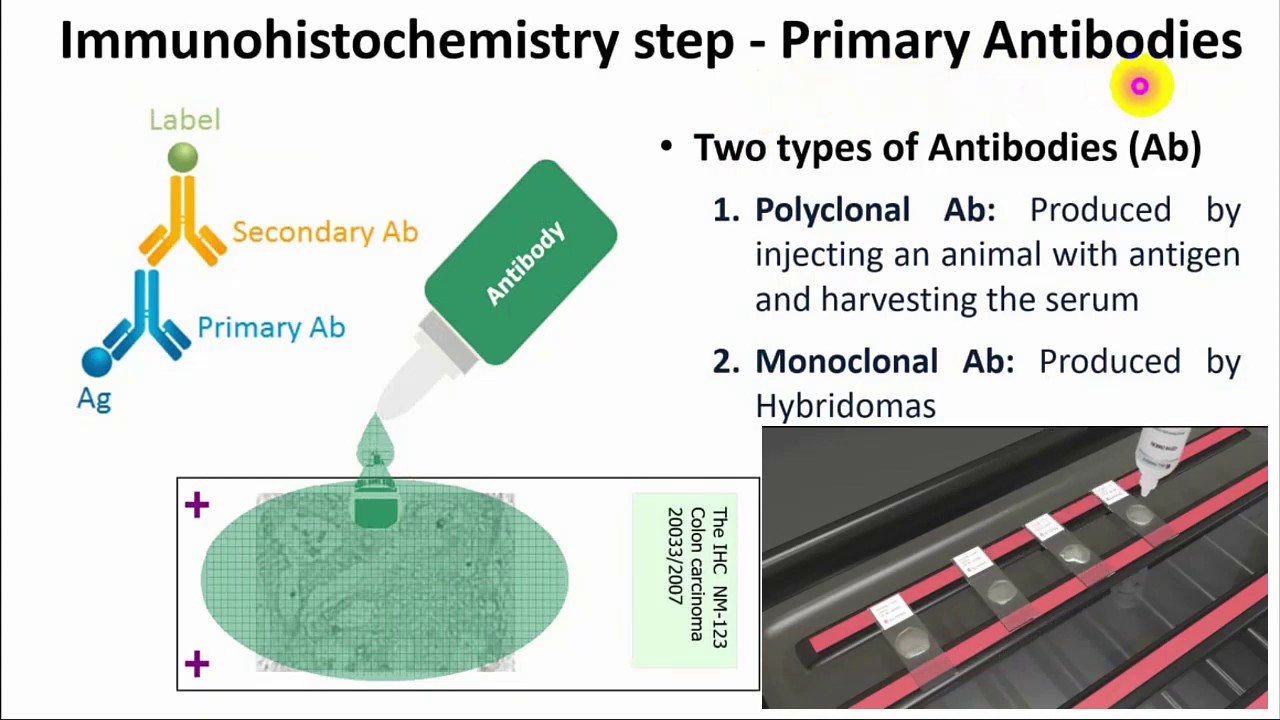 IHC Immunohistochemistry الكيمياء النسيجية المناعية