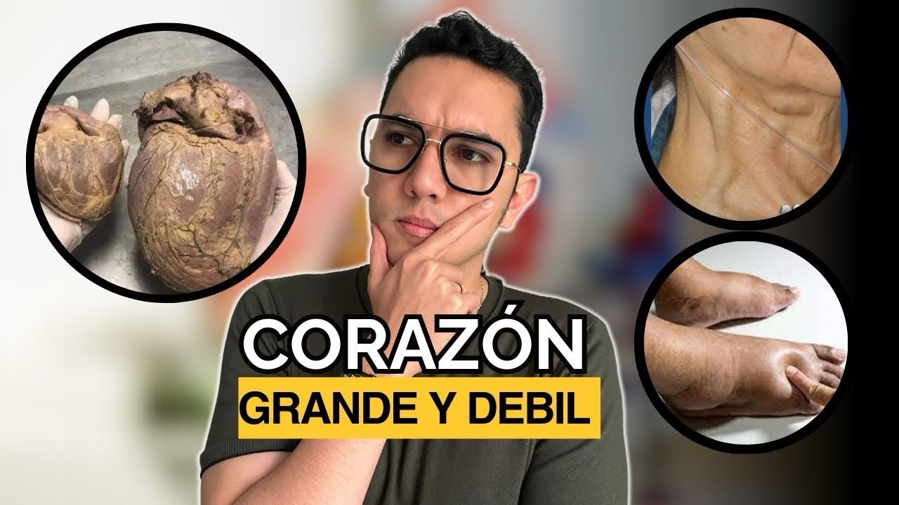 ¡Alerta! Corazón grande y débil | Dr. William Guerrero