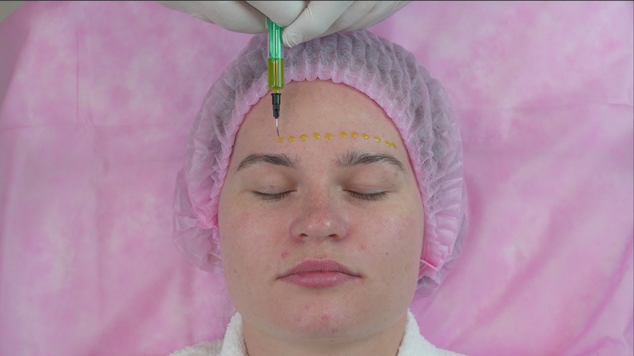 BioRePeelCl3 протокол монопроцедуры BioReTherapy