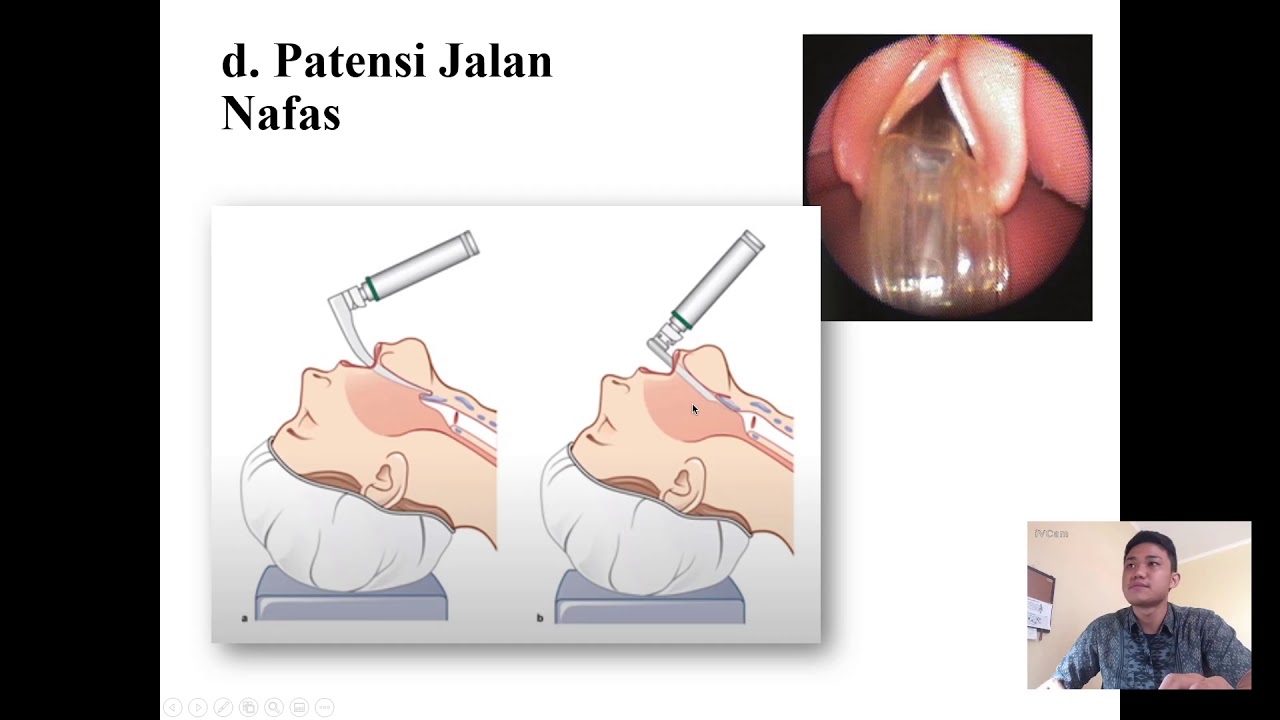 Anestesi Umum dan Anestesi Spinal