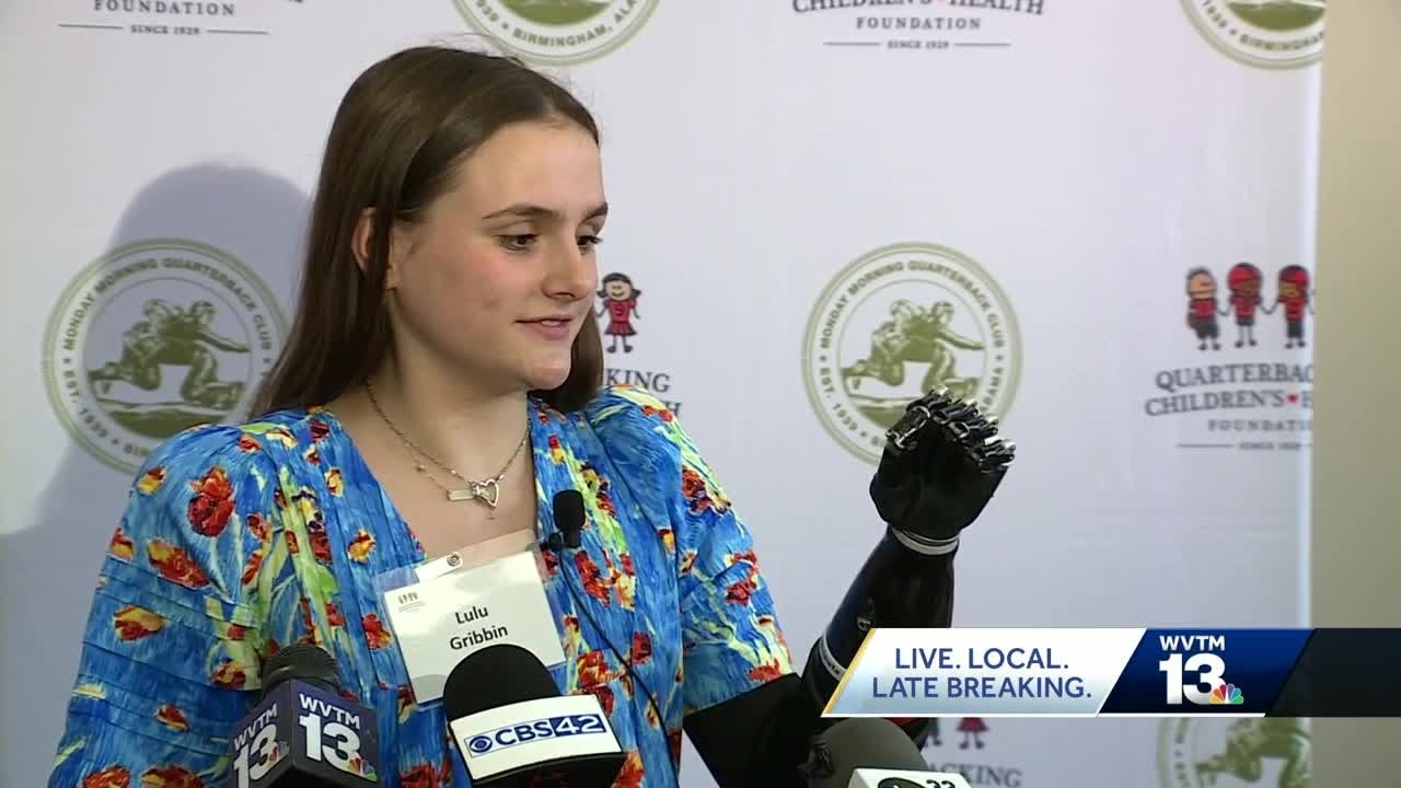 Alabama shark attack victim shares her story