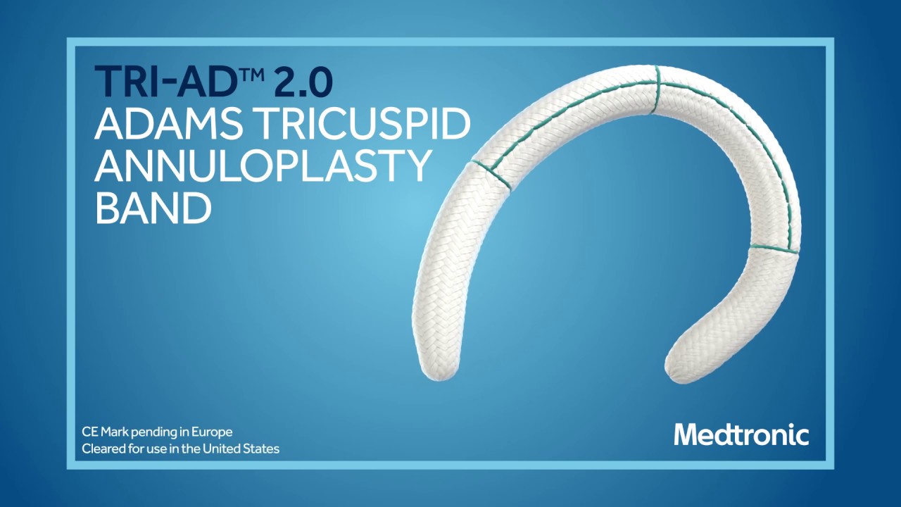 Tri-Ad&trade;  2.0 Adams Annuloplasty Band