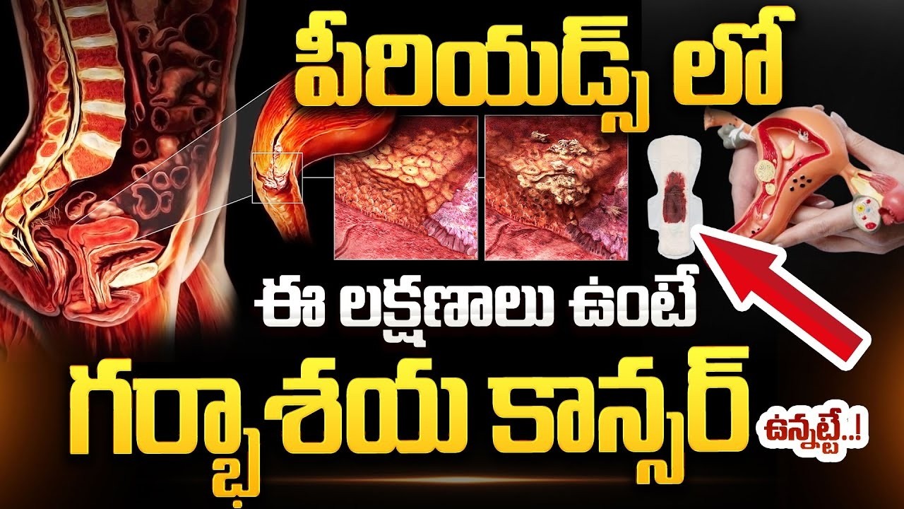గర్భాశయ క్యాన్సర్&zwnj;..| Cervical Cancer Symptoms And Treatment | Dr Sailakshmi Daayana | Cancer
