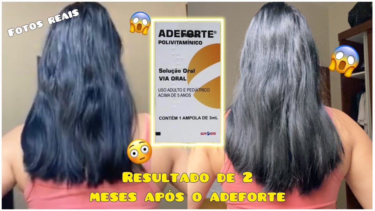 RESULTADO De DOIS MESES DO ADEFORTE | cresce cabelo/ fotos reais