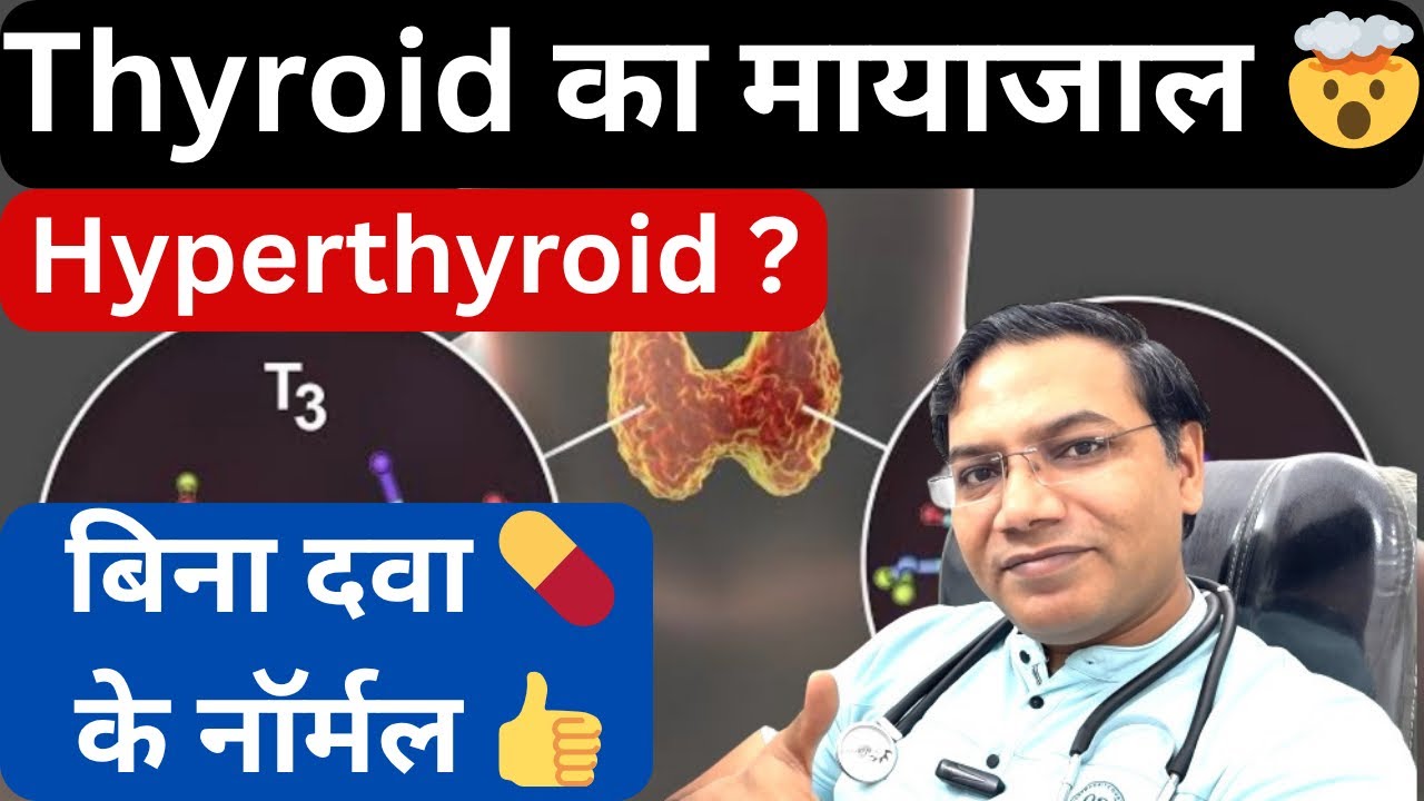 Hyperthyroid ? बिना दवा के नार्मल 🧐|| Thyroid का मायाजाल part 3 #hyperthyroid #thyroid 