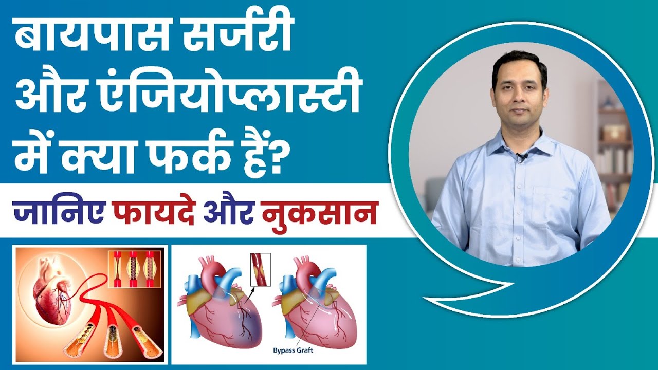 Which is Better Angioplasty or Bypass Surgery | जानिए फायदे और नुकसान | Dr.  Ashar Khan-Cardiologist