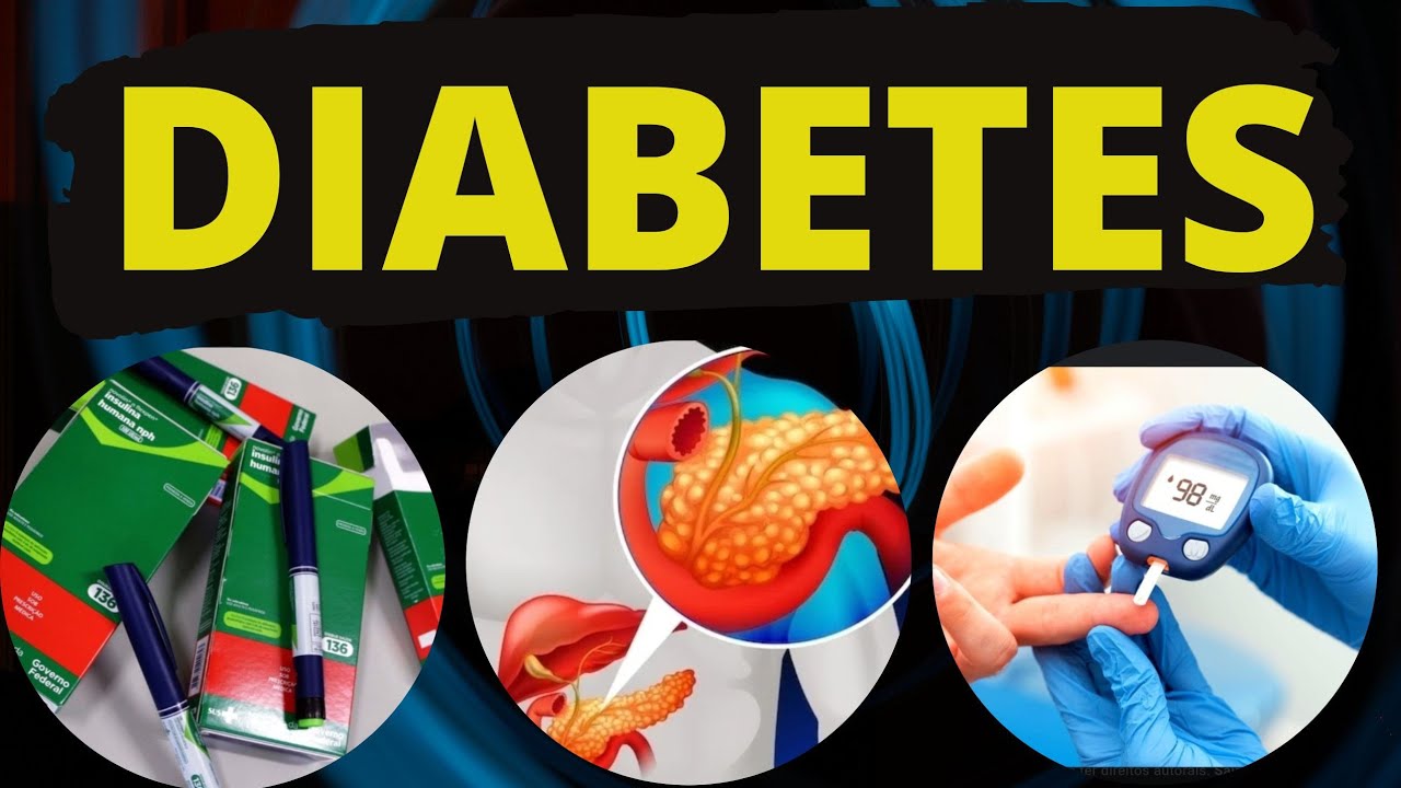 DIABETES - Definição,  classificação e fatores de risco.