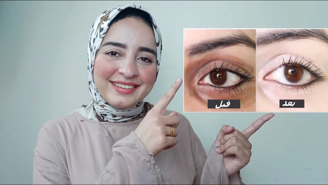 اسرع علاج وكريمات للتخلص من الهالات السوداء و الانتفاخات والخطوط تحت العين 👌